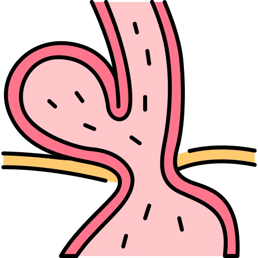 Hiatal Hernia