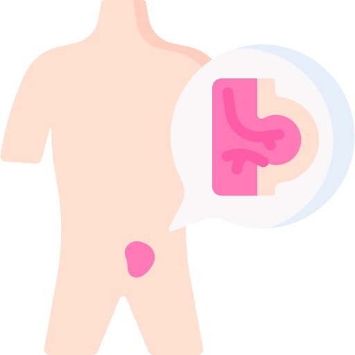 Inguinal Hernia