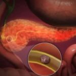 WhatsApp Image 2025 09 04 at 14 26 05 150x150