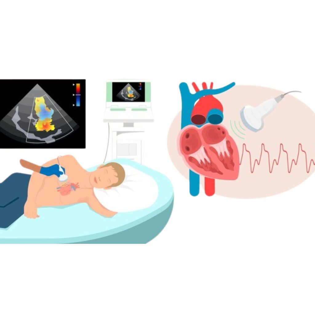Echocardiography (2D/3D Echo)