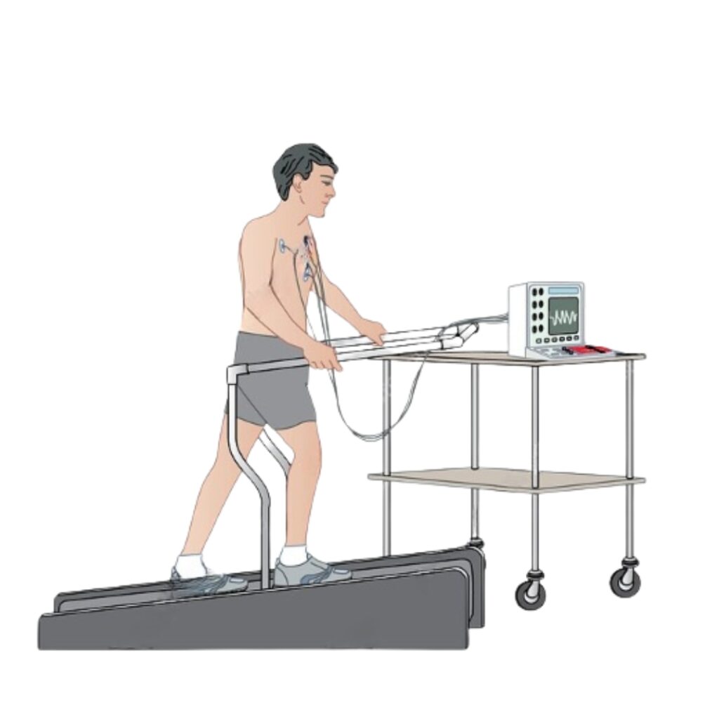 Treadmill Test (TMT / Stress Test)