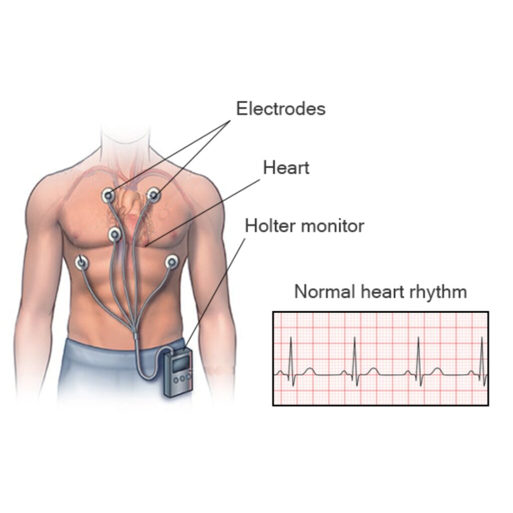 Electrocardiogram (ECG/EKG)