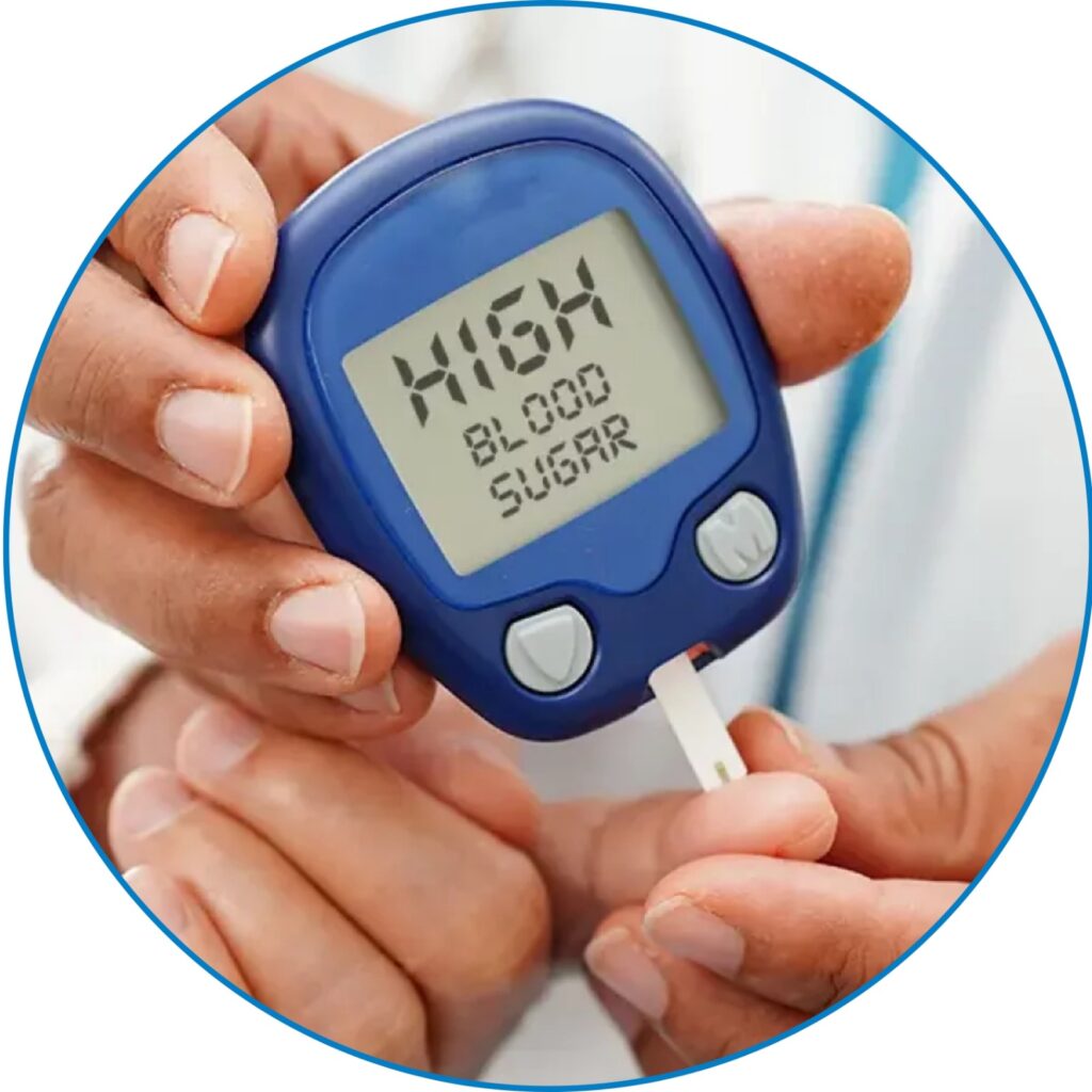 Hyperglycemia (High Blood Sugar) at kkcare hospital
